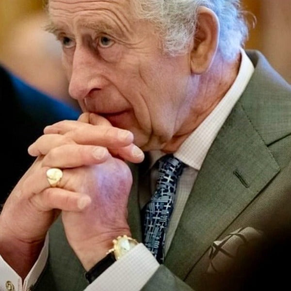 A close-up of a man's chest wearing a striped tie, with the tie's pattern not visible in the image.
